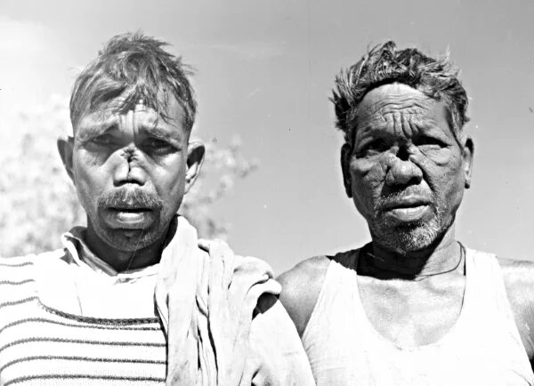 Проказа фото людей на поздней стадии File:Two lepers, M.P., India, 1960 (16979054665).jpg - Wikimedia Commons