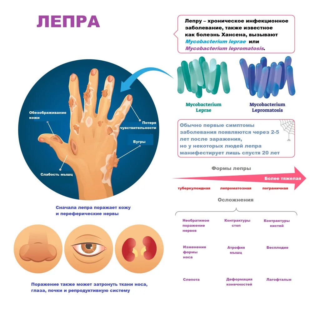 Проказа симптомы фото Новости и репортажи