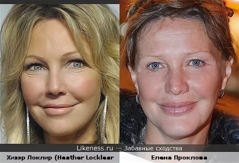 Проклова фото после пластики Неудачная пластика на лицо... Хизэр Локлир (Heather Locklear) и Елена Проклова..