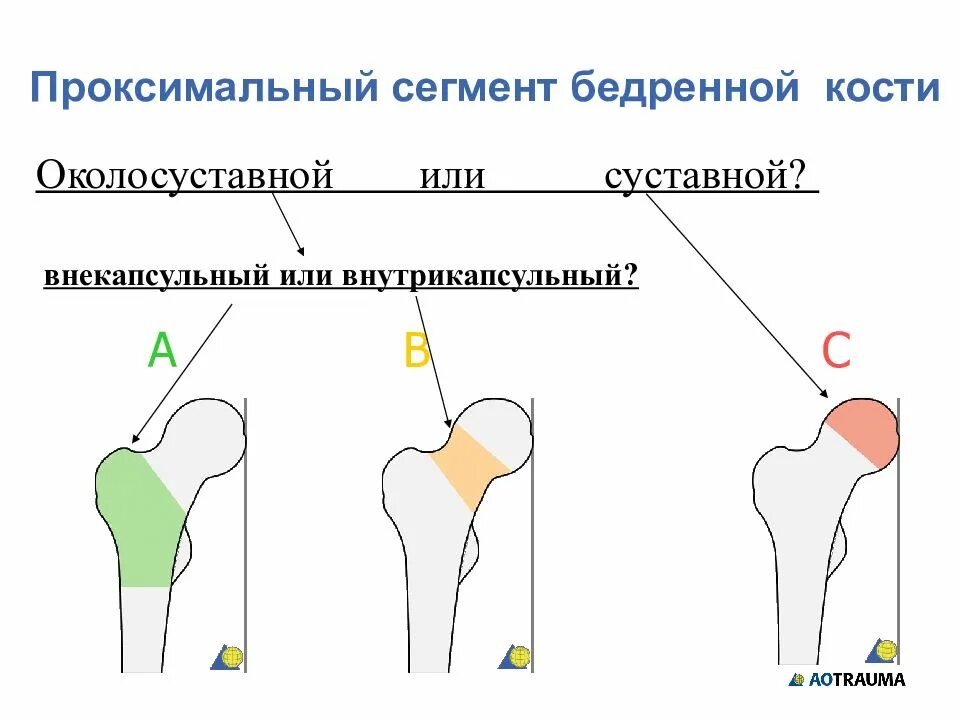 Проксимальный отдел бедренной кости фото Проксимальный отдел бедренной кости