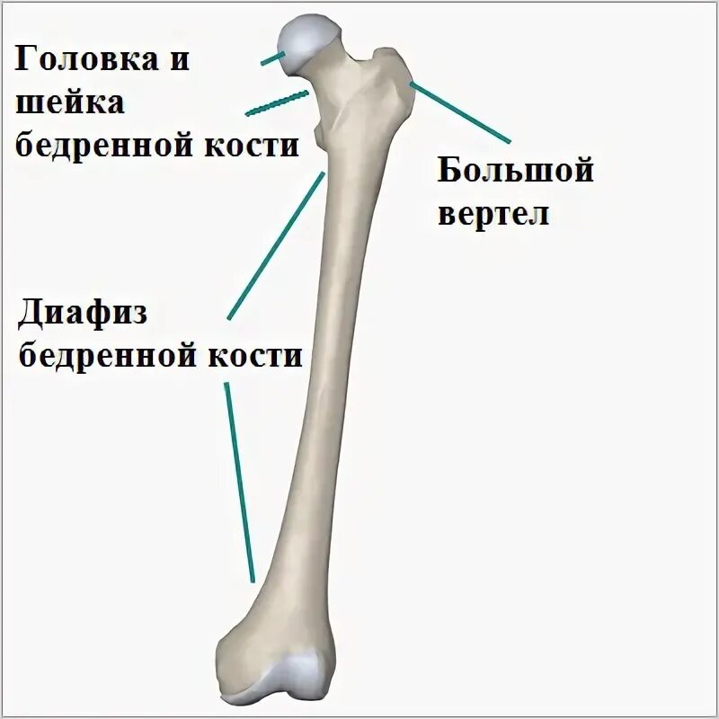 Проксимальный отдел бедренной кости где находится фото Перелом бедренной кости (диафиз). Симптомы и лечение