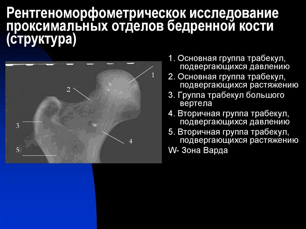 Проксимальный отдел бедренной кости где находится фото Оценка прочности проксимальных отделов бедренной кости при рентгенодиагностическ