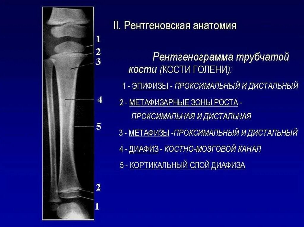 Проксимальный отдел большеберцовой кости фото Дистальные отделы нижних конечностей: найдено 72 изображений