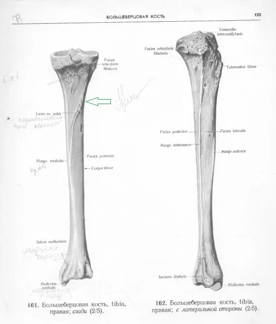 Проксимальный отдел большеберцовой кости где находится фото Изменение кортикального слоя? Портал радиологов