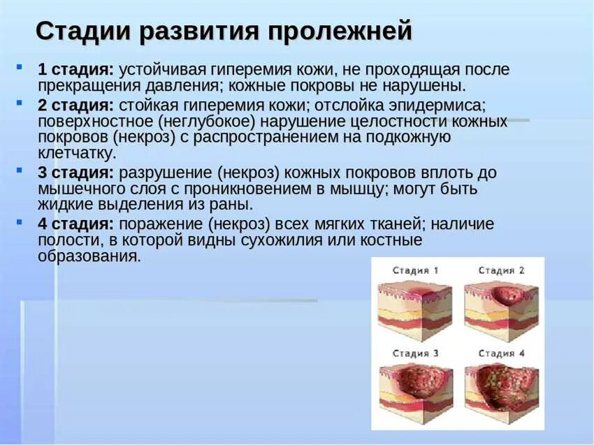 Пролежень 3 стадии фото Почему образуется твердая корочка на шарлотке и как ее предотвратить