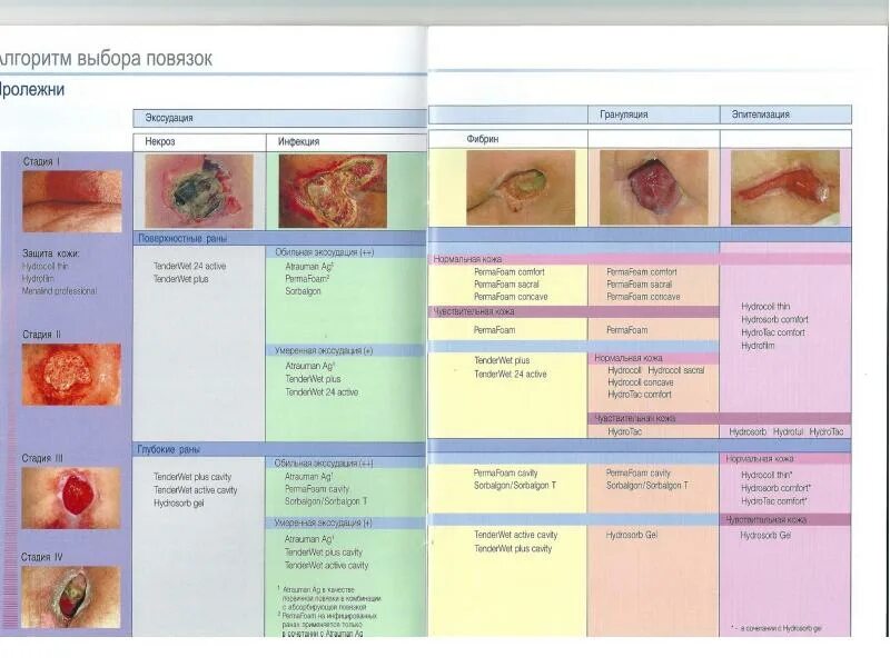 Пролежни фото по стадиям УХОД ЗА ПАЦИЕНТОМ ПРОЛЕЖНИ - L89 (МКБ10) профилактика и лечение
