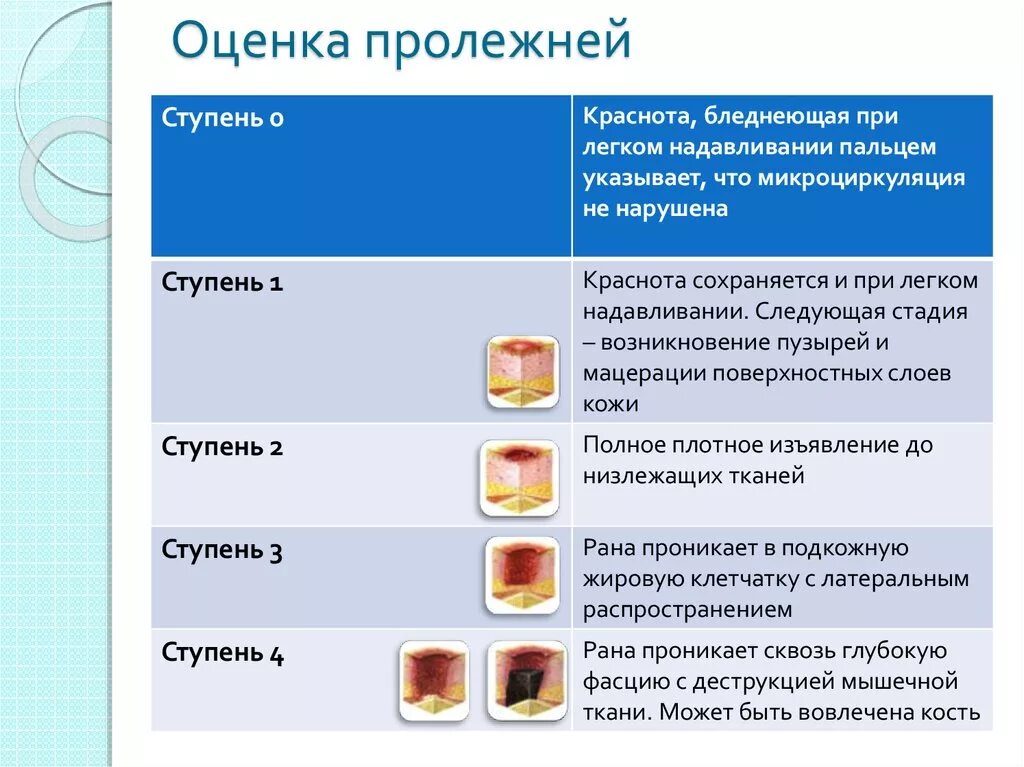 Пролежни разных стадий фото Задача пролежни - найдено 55 картинок