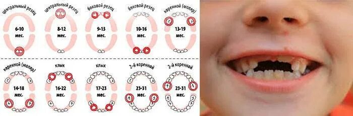 Прорезывание молочных зубов у детей фото Прорезывание зубов у детей: когда начинают расти