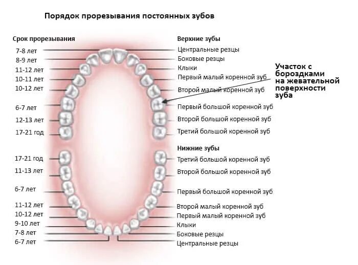 Прорезывание зубов схема фото Зубные герметики