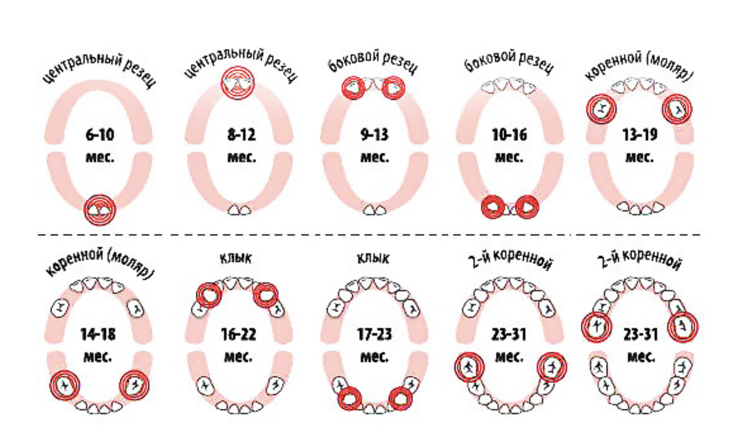 Прорезывание зубов верхних фото как выглядит Как режутся молочные зубы у детей - схема и сроки появления первого зуба