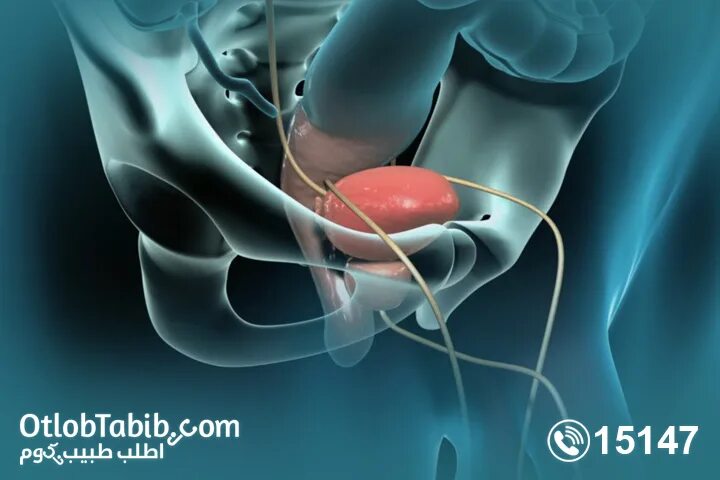 Простата симптомы фото What is prostate enlargement, its causes and methods of treatment