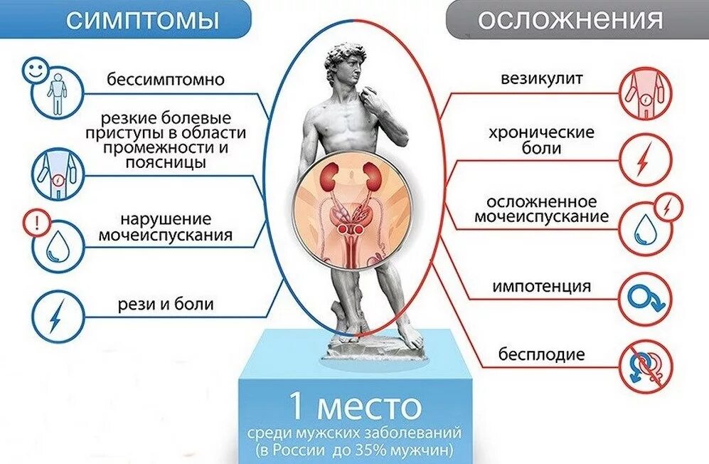 Простата симптомы у мужчин фото Лечение простатита и аденомы простаты в Сарове Клиника "Ника Спринг"