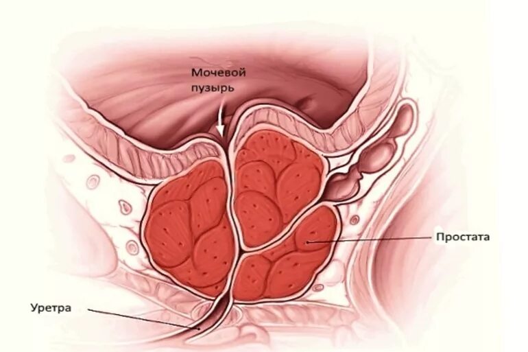 Простата снаружи фото Воспаление простаты: причины и симптомы патологического процесса, лечение предст