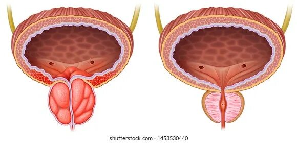 Простата снаружи у мужчин фото 597 Comparing muscles: immagini, foto stock e grafica vettoriale Shutterstock