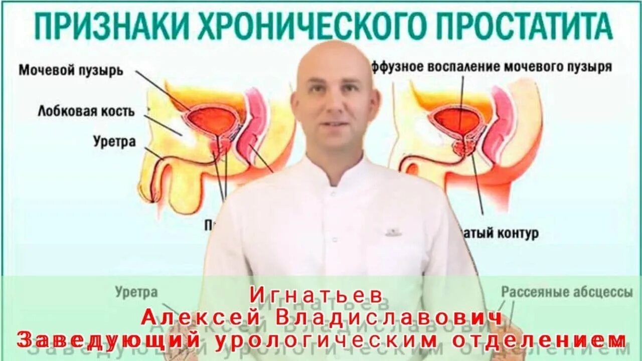 Простатит симптомы фото Хронический простатит. - YouTube