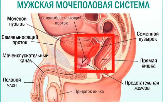 Простатиты симптомы и лечение фото Преждевременная эякуляция, боль в яичках? Это мог быть простатит. Как их лечить?