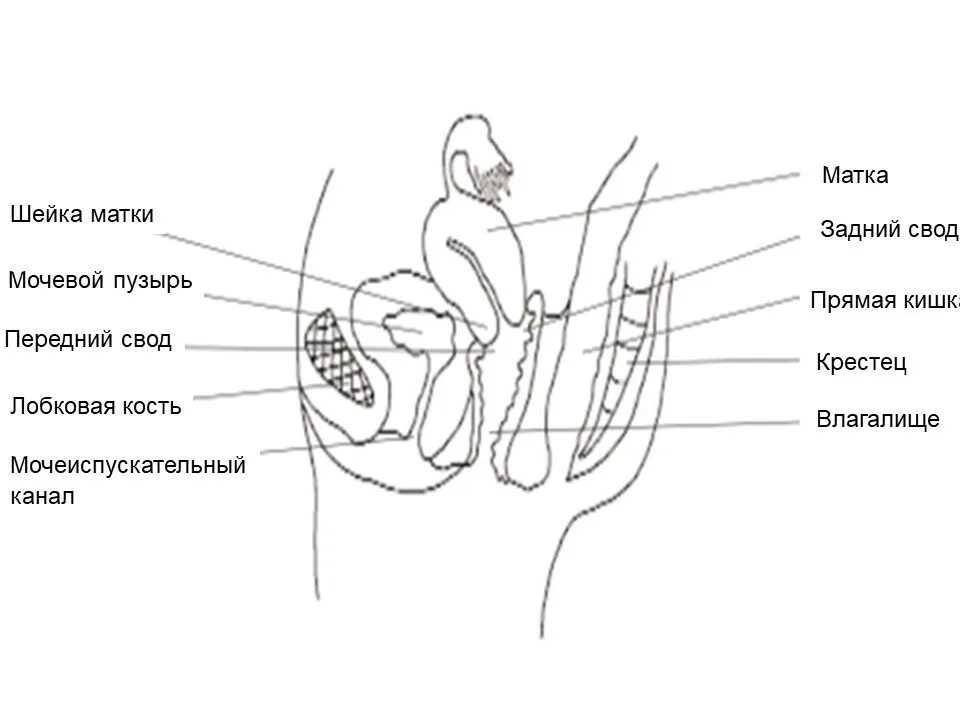 Простейший вариант сделать женское влагалище дома Atlas of visual inspection of the cervix with acetic acid for screening, triage,