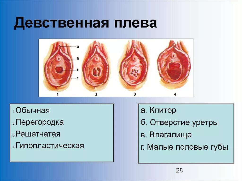 Простейший вариант сделать женское влагалище дома Хирургическая дефлорация Медицинский центр Эра