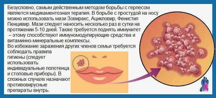 Простудный герпес на теле фото Antibiotics trigger herpes outbreak