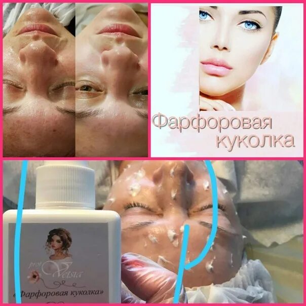 Процедура фарфоровая кукла отзывы фото Professional peeling procedures Porcelain skin for the face is an effective alte