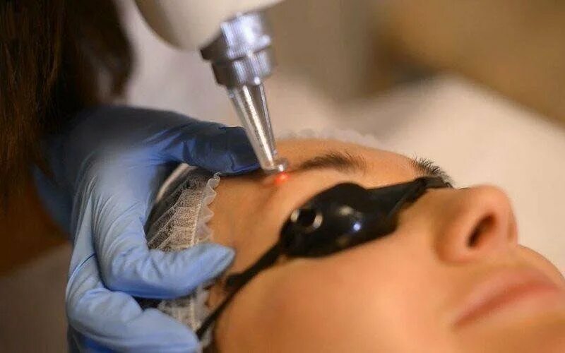 Процедура удаления лазером татуажа Dott. Virgilio Medical Laser, пластическая хирургия, Апулия, Бари, Via Melo da B