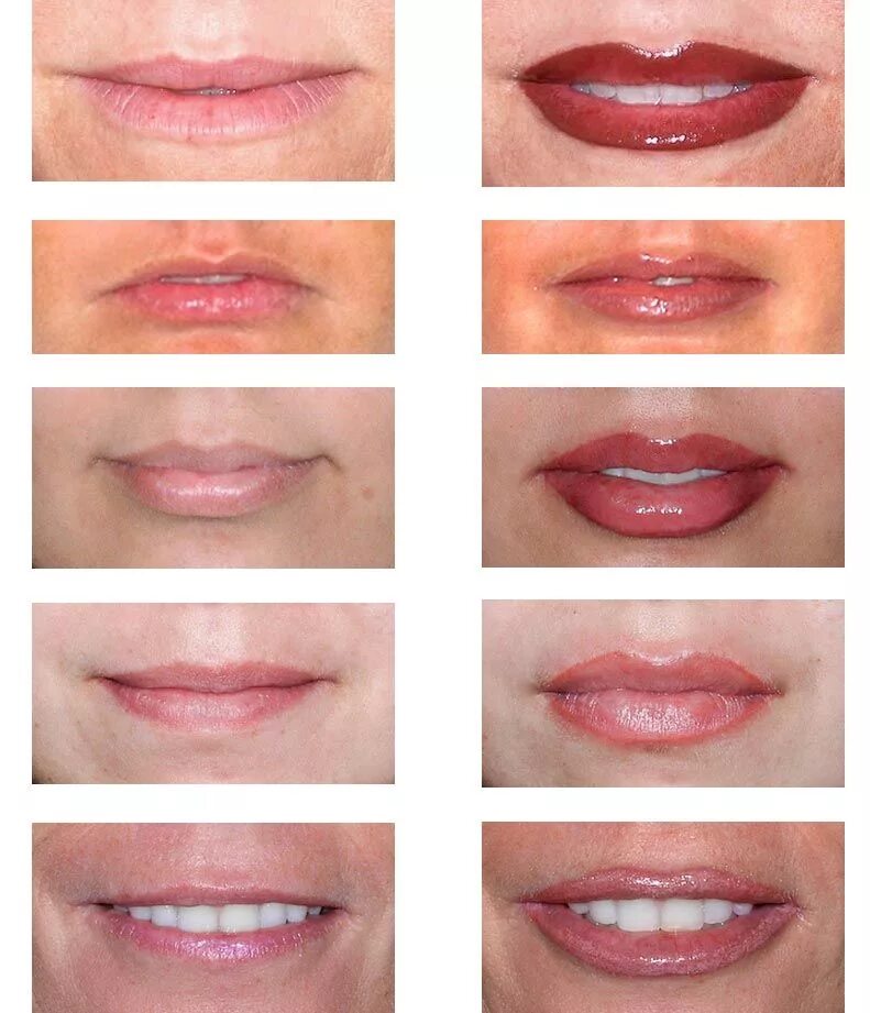 Процесс заживления перманентного макияжа губ по дням Before & After- Permanent Lip Makeup . Permanent makeup eyeliner, Lip permanent 