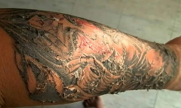 Процесс заживления тату фото Life Trrends Tattoo healing stages, Healing tattoo, Tattoo healing process