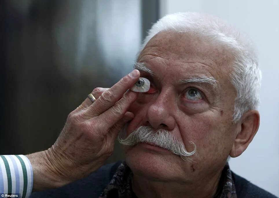 Протез глаза фото How glassmaker's incredibly realistic prosthetic eyes are giving hope to victims