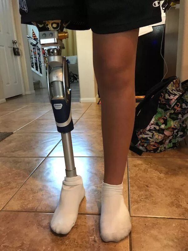 Протез ноги выше колена фото 3D Print Aesthetic Leg Prosthetic - Make: in 2023 Prosthetics, Orthotics and pro