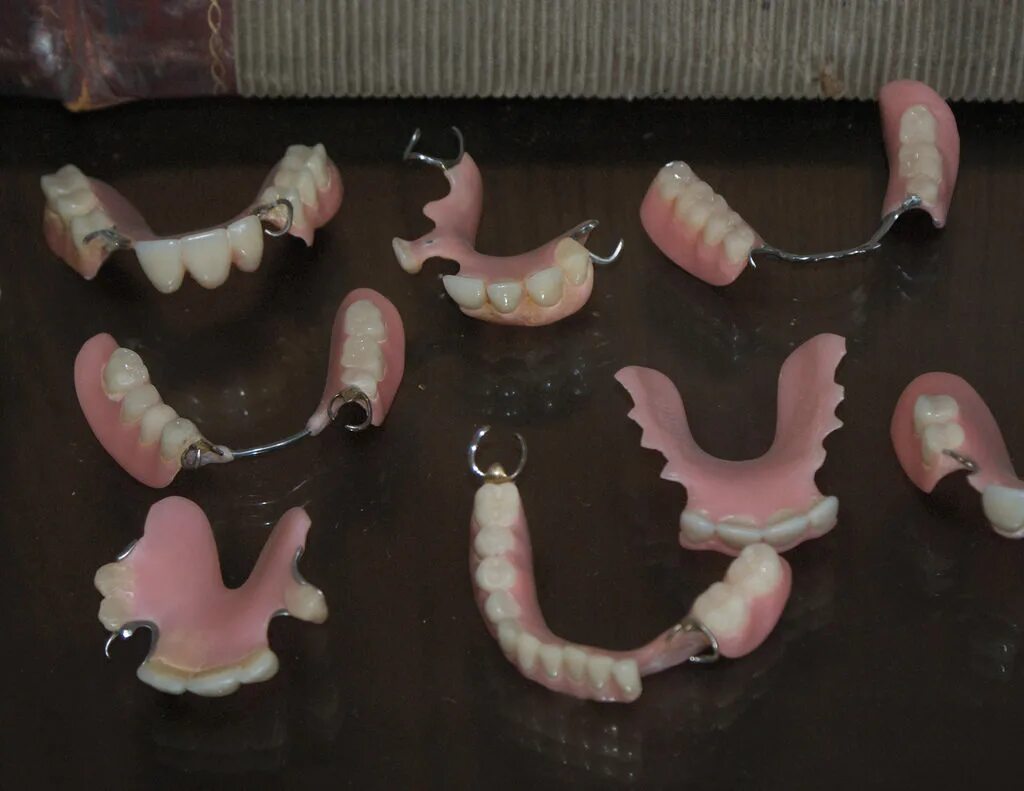 Протез своими руками в домашних условиях In Texas State Prisons, Dentures Are Rarely Deemed 'Medically Necessary' Texas S