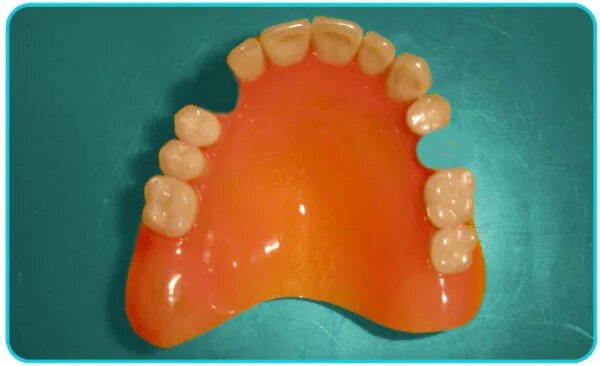 Протез верхней челюсти на присосках фото мужской разговор : картинки : зубные протезы на присосках