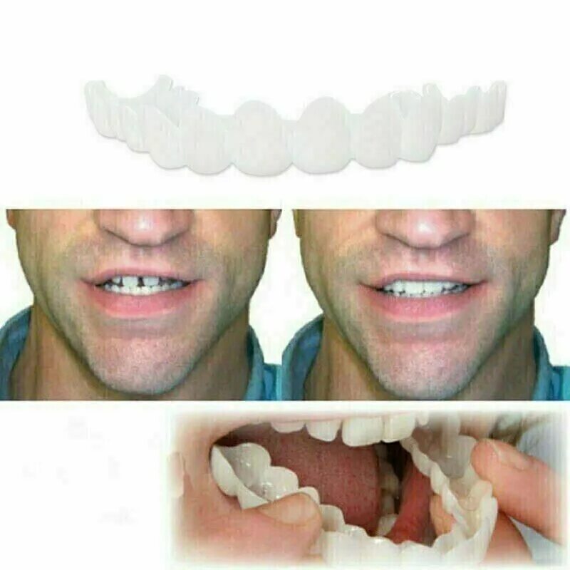 Протез зуба фото до и после Snap On False Teeth Upper + Lower Dental Veneers Dentures Tooth Cover Set Hot eB