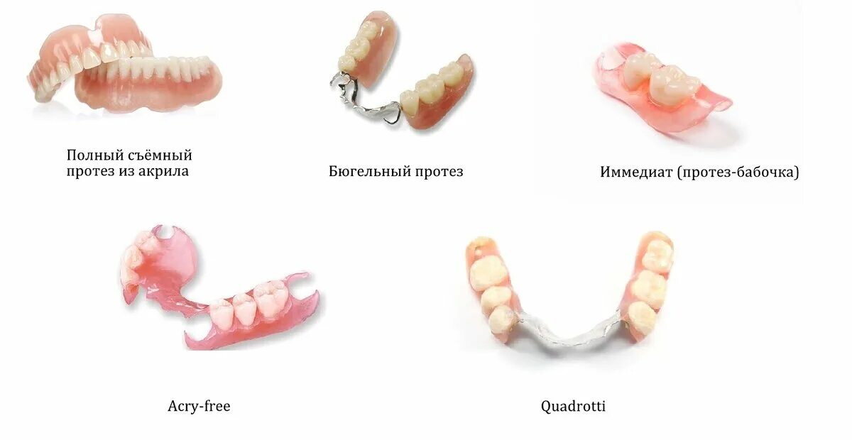 Протезирование зубов виды протезов фото цена Какой съёмный зубной протез лучше? Виды и цены. Сеть стоматологических клиник "Р