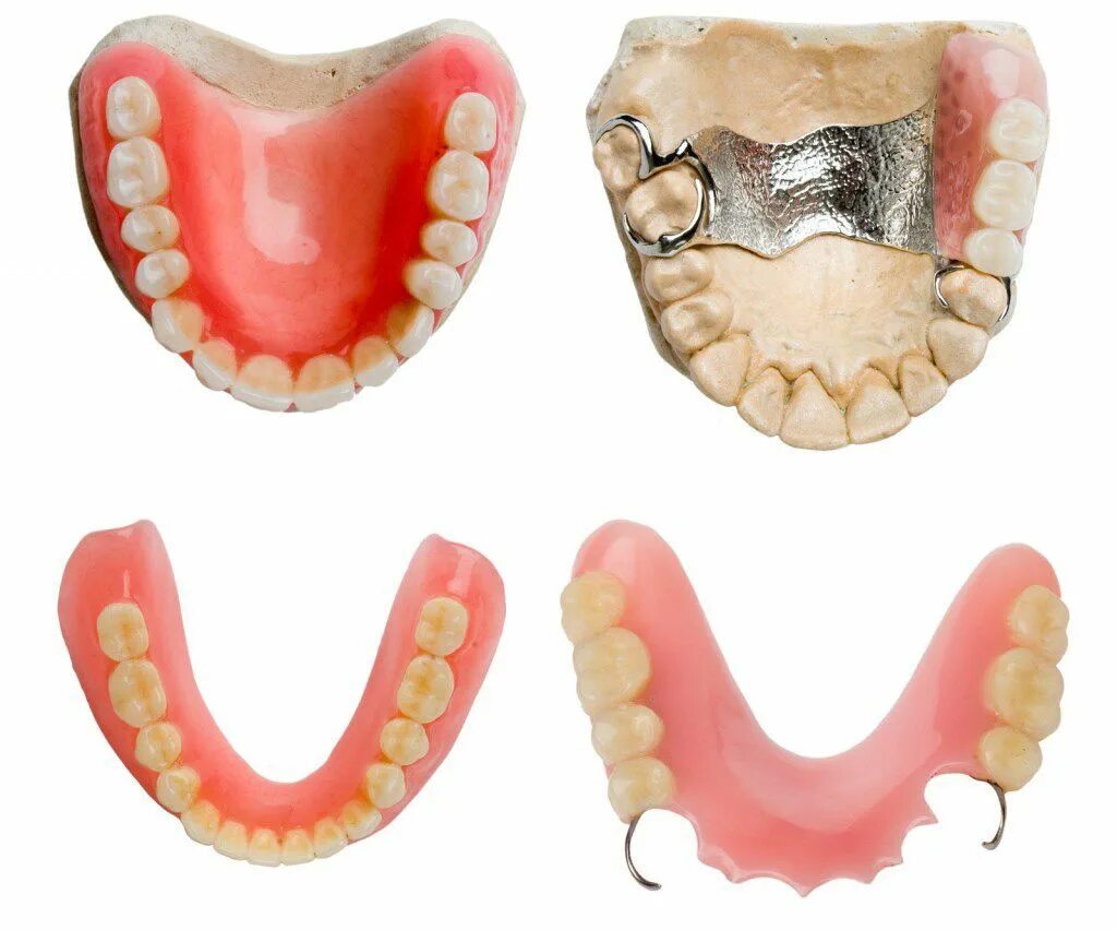 Протезы на жевательные зубы верхней челюсти фото Протезирование верхних зубов в Москве