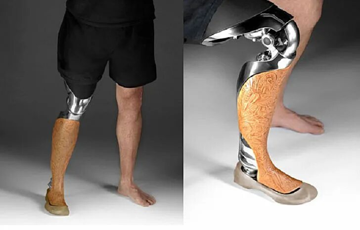 Протезы выше колена цена и фото These Beautiful Customized 3D-Printed Prosthetic Legs Are Made to Be Seen Prosth