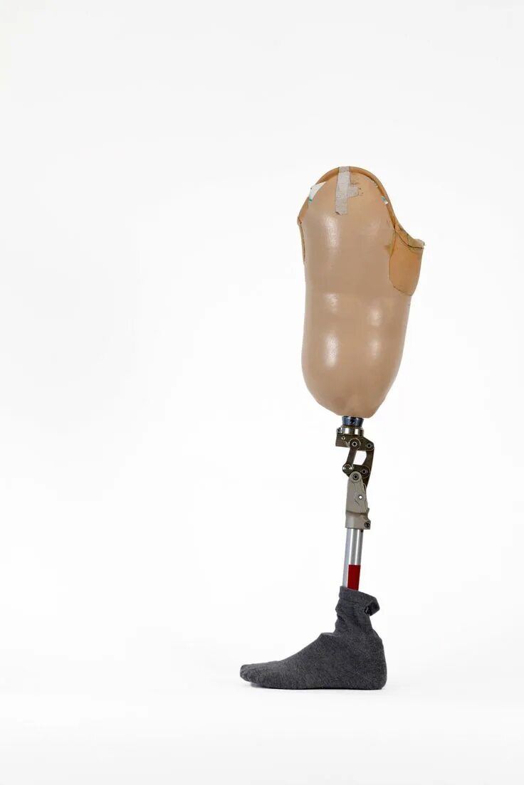 Протезы выше колена цена и фото Advantages of Prosthetic Legs, 2020 (Görüntüler ile)