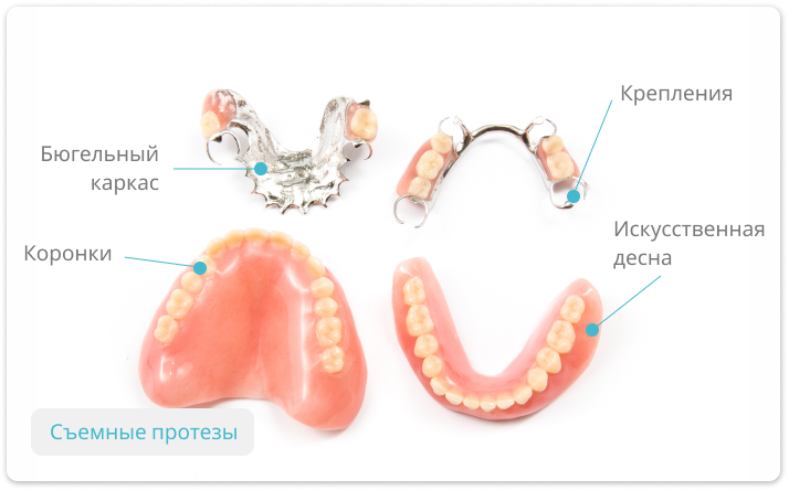 Протезы зубов виды фото Съемные протезы зубов: цены, изготовление и виды протезирования - Стоматология Е