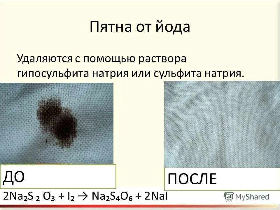 Проверка йодом на лишай фото Как быстро и эффективно удалить пятно от йода с ткани: проверенные советы Лайфха