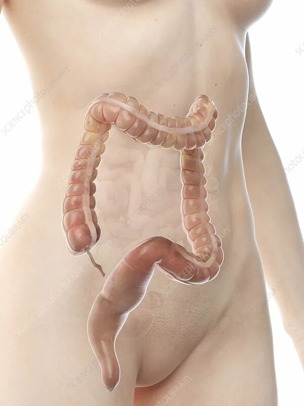 Прямая кишка фото внутри Large intestine, illustration - Stock Image - F027/3614 - Science Photo Library