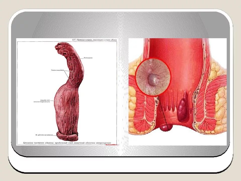 Прямая кишка фото внутри Презентация на тему: Строение стенки аппендикса
