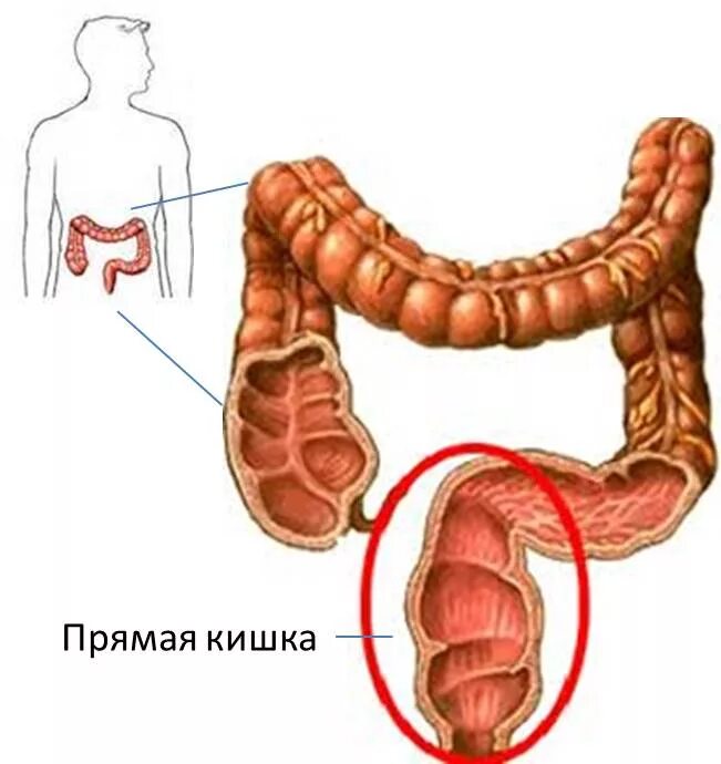 Прямая кишка строение у женщин фото Проктит: причины, симптомы, методы диагностики и лечения проктита