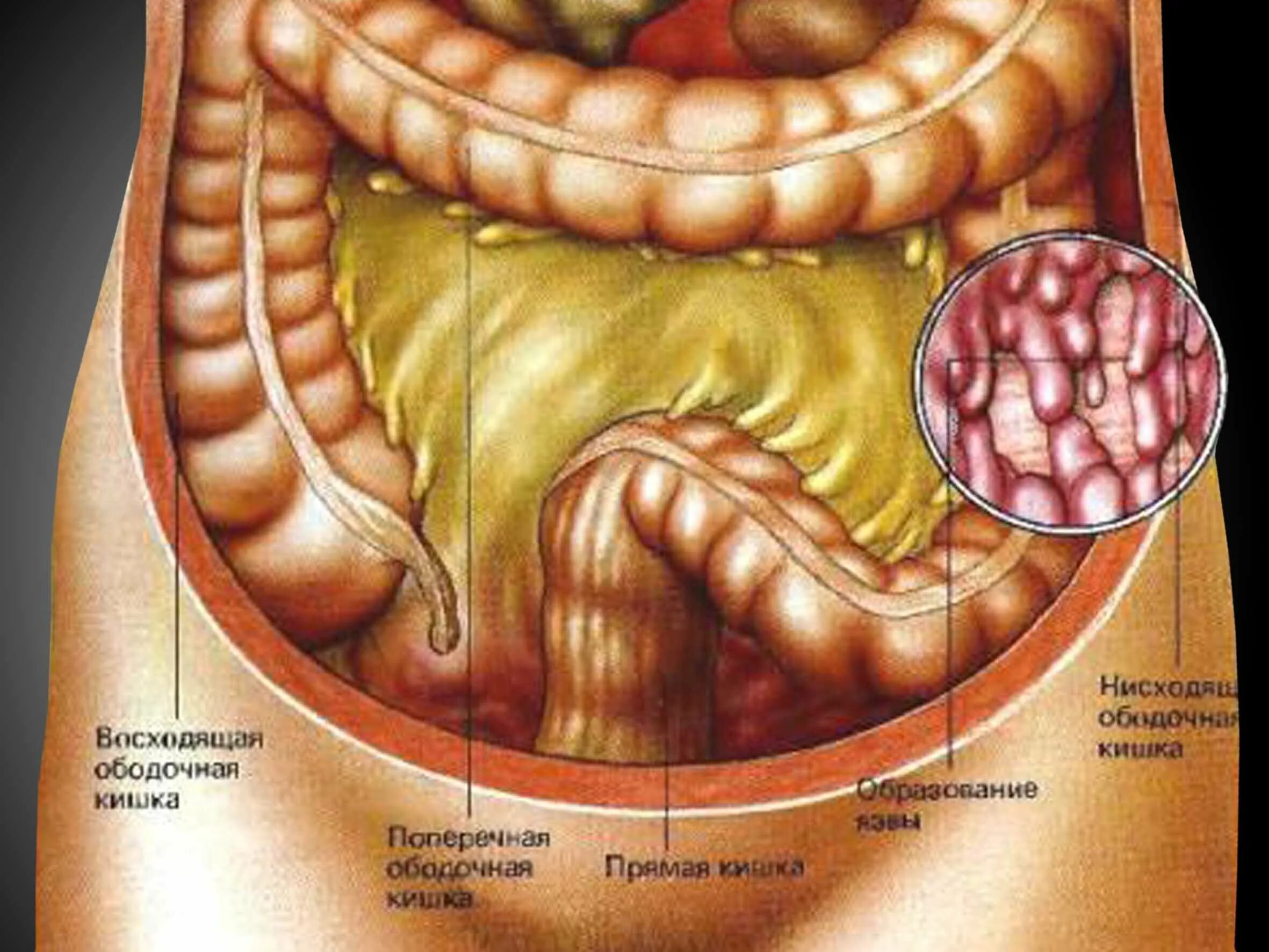 Прямая кишка строение у женщин фото Строение кишечника человека в картинках у женщин