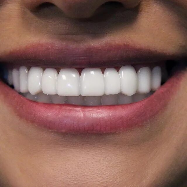 Прямые зубы фото Cómo blanquear los dientes en casa - CRÉATE A TI MISMA Dientes perfectos, Dentad