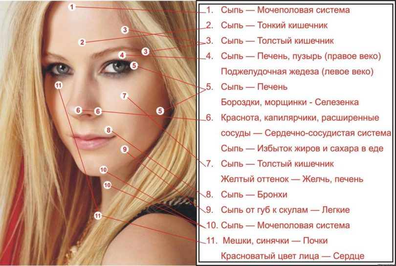 Прыщи на небе фото Психологические причины болезней кожи лица. Акне, Кожа, Лицо