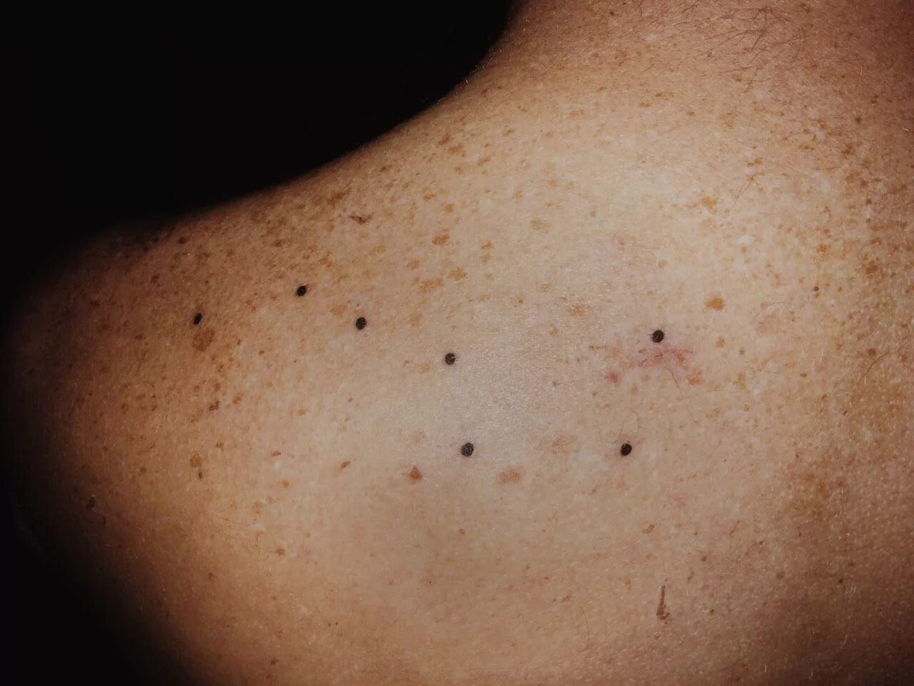 Прыщи от солнца на спине фото Constellation Freckle Tattoo - if anything this would be my first tattoo Big dip