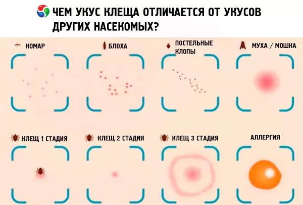 Прыщи от укуса клопа фото Tick bites in humans: symptoms, complications and treatment