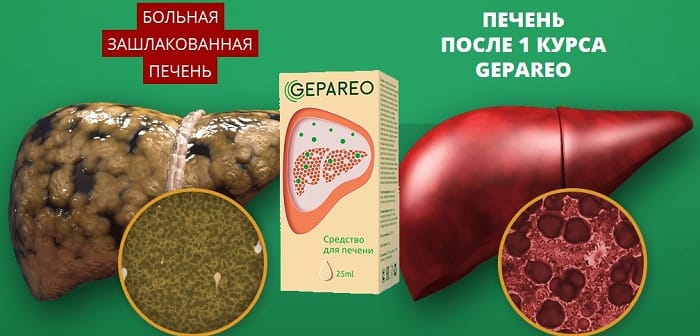 Прыщи печень фото ⌛ ️Gepareo (Гепарео) для восстановления печени. Отзывы. Цена. Где купить. Состав 