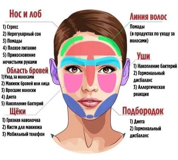 Прыщи схема расположения на лице Causes of acne on the face. 0% жирности ВКонтакте