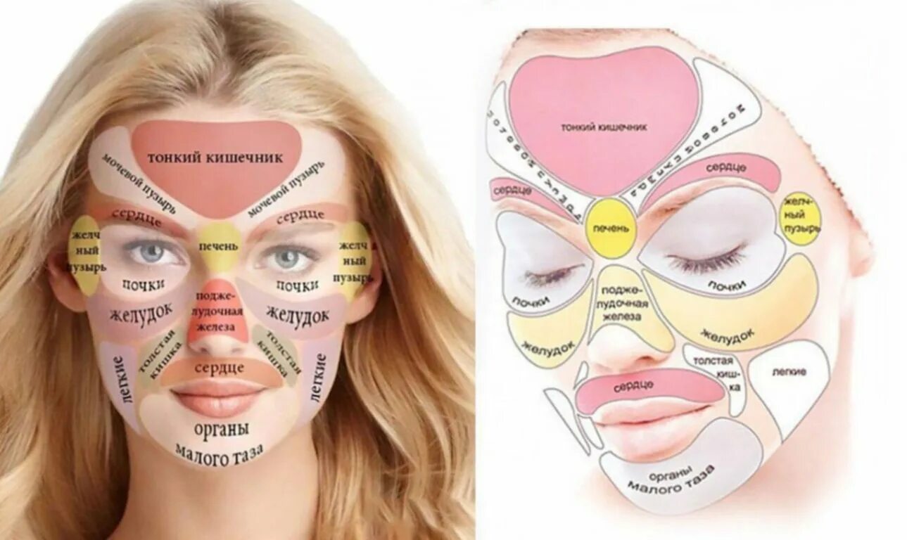 Прыщи схема расположения на лице Места прыщей на лице