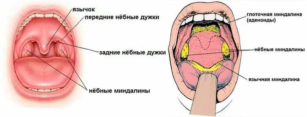 ГБУЗ СО "Тольяттинская городская клиническая больница № 5" - Нужно ли удалять гл